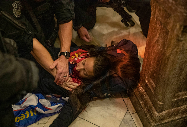 Получившая ранение в Капитолии женщина