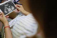 «Я была ужасно напугана» Россиянки приходят к врачам перед абортом. Как эти консультации ломают им жизнь?